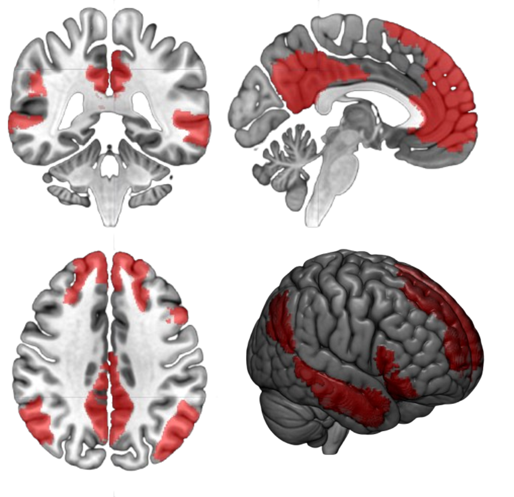 Default Mode Network MPR